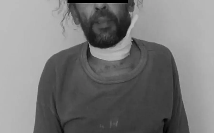 A vinculación imputado por Maltrato Animal y Lesiones Calificadas en Lachigoló