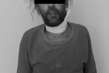 A vinculación imputado por Maltrato Animal y Lesiones Calificadas en Lachigoló