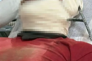 ¡Grave accidente en Oaxaca! obrero es empalado con varilla 