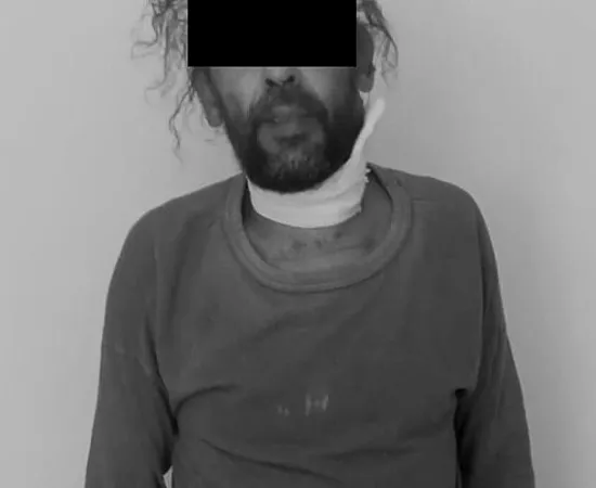 A vinculación imputado por Maltrato Animal y Lesiones Calificadas en Lachigoló