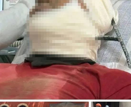 ¡Grave accidente en Oaxaca! obrero es empalado con varilla 