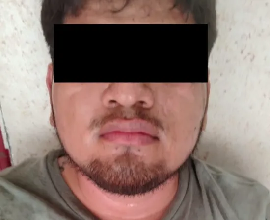 FGEO detiene en el Istmo a hombre con orden de aprehensión; dispara contra agentes durante su captura